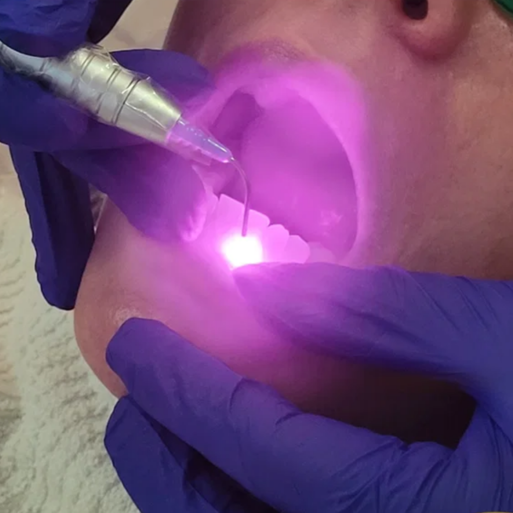 Laser Therapy