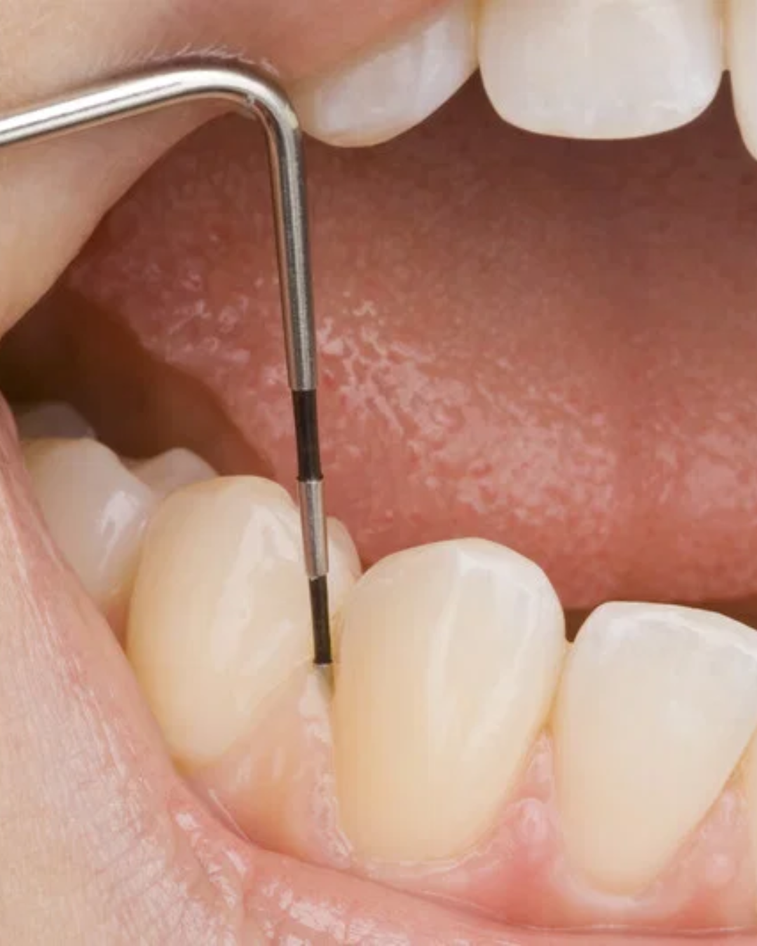 Comprehensive Oral Wellness Exam in Calgary