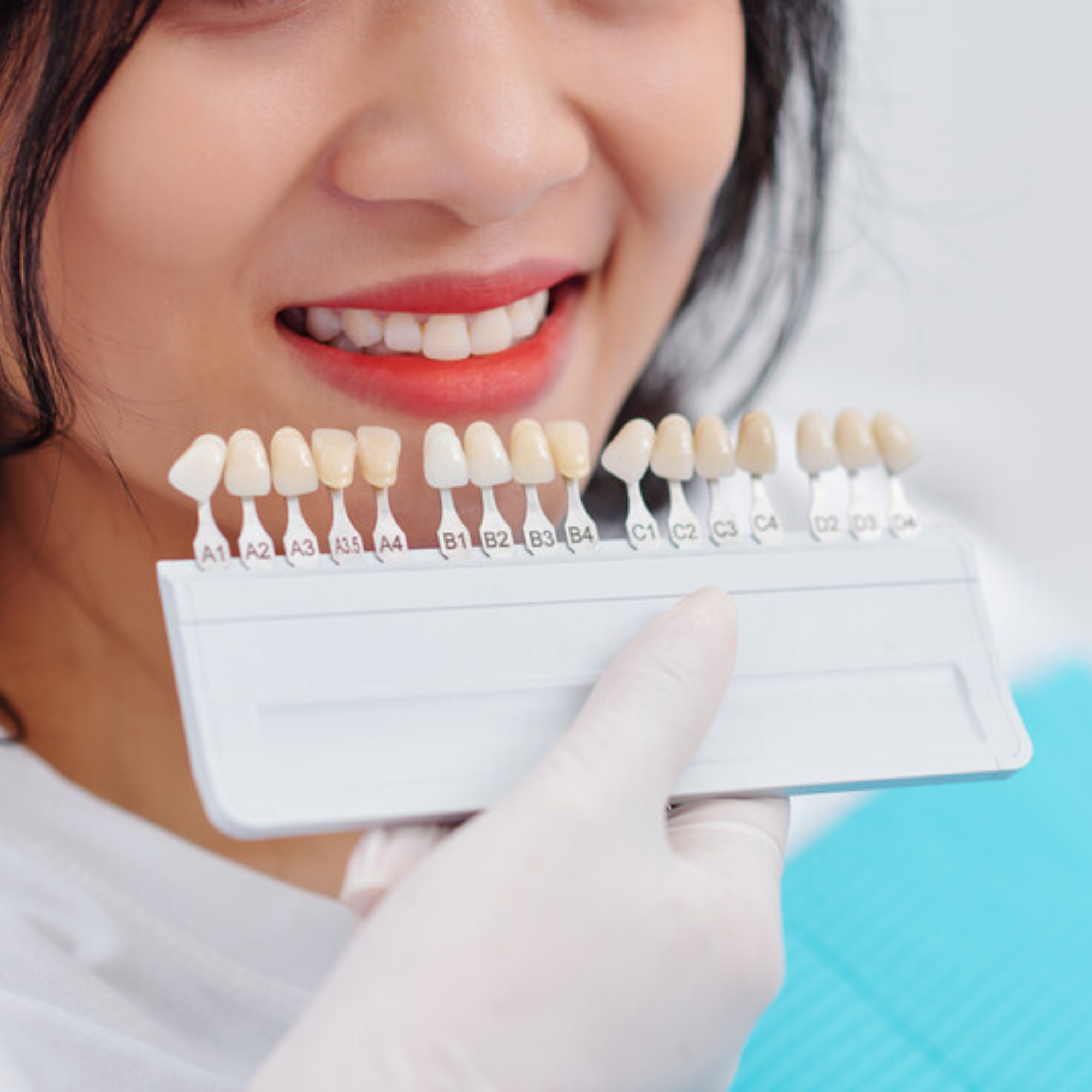 Teeth Whitening
