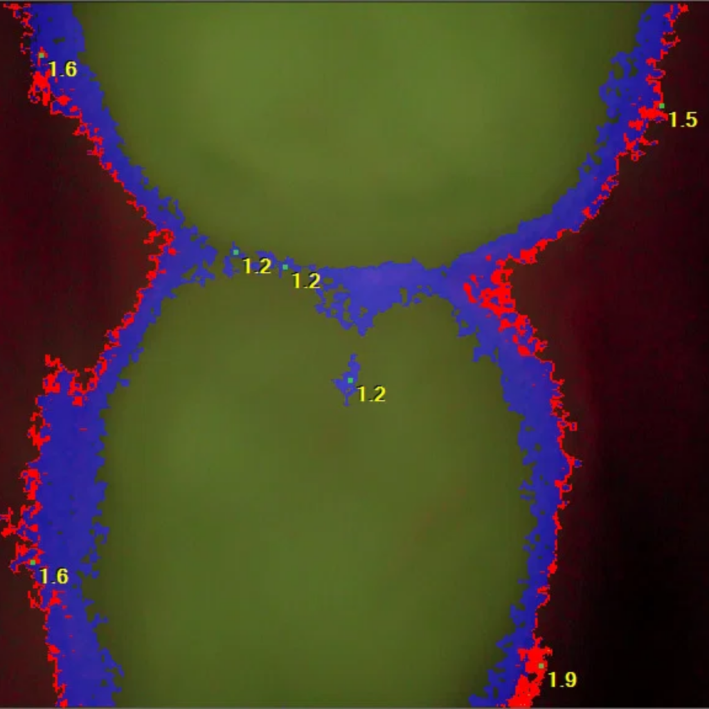 Spectra Intra-oral Camera